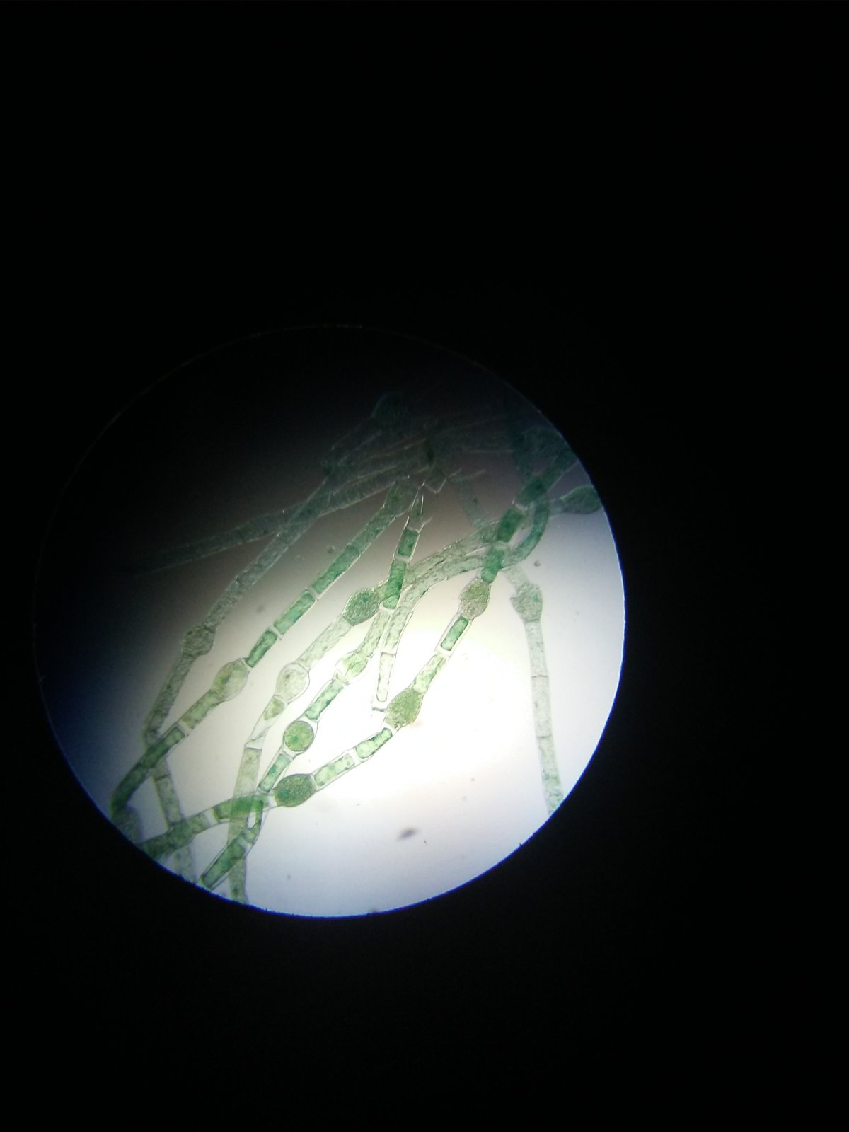 Řasa Oedogonium pod mikroskopem – Mookul Samader / Shutterstock