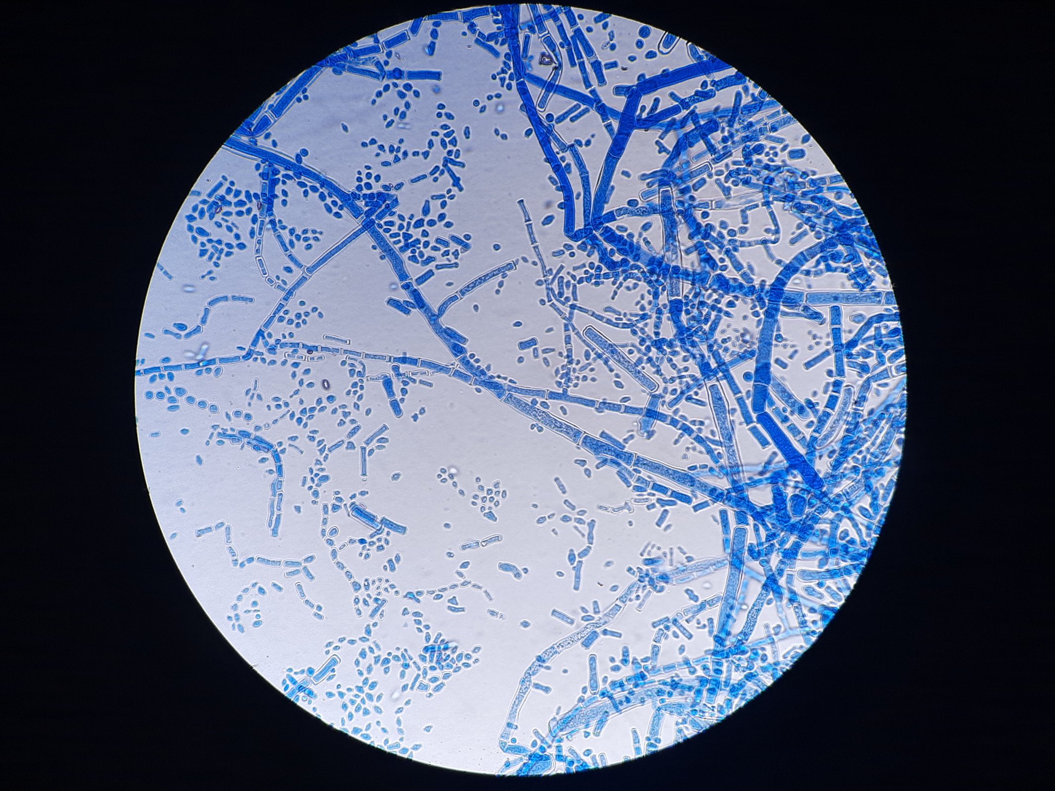 Plíseň Neurospora sitophila pod mikroskopem – Jc imprint / Shutterstock