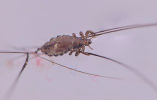 Veš dětská (Pediculus capitis) – FotoPixy / Shutterstock