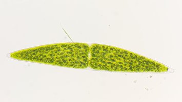 Řasa Closterium lunula, snímek z mikroskopu – Ekky Ilham / Shutterstock