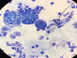 Bakterie Chlamydia trachomatis pod mikroskopem – Ekaterina Avd / Shutterstock