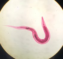 Roup dětský (Enterobius vermicularis) pod mikroskopem – Anestial / Shutterstock