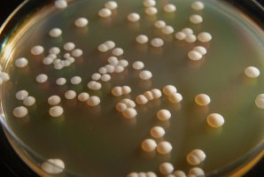 Kolonie kvasinek druhu Saccharomyces cerevisiae na živném roztoku – Rafael Zarate / Shutterstock