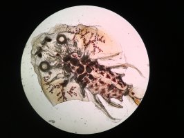 Parazit kapřivec plochý (Argulus foliaceus) pod mikroskopem – Ice Jo / Shutterstock