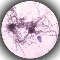 Mikroskopicky zvětšená houba Malassezia furfur – Arif biswas / Shutterstock