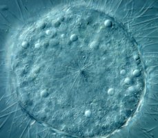 Slunivka osténka (Acanthocystis) pod mikroskopem – Maple Ferryman / Shutterstock