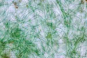 Sinice z rodu Anabaena pod mikroskopem – Rattiya Thongdumhyu / Shutterstock