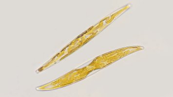 Mikroskopicky zvětšená rozsivka rodu Pleurosigma – Ekky Ilham / Shutterstock