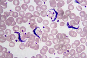 Parazitický prvok Trypanosoma v krevním nátěru pod mikroskopem – blood smear / Shutterstock