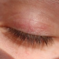 Oční víčko dítěte – Avakov / Shutterstock