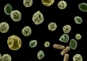 Mikroskopicky zvětšená pylová zrna – S.Zykov / Shutterstock