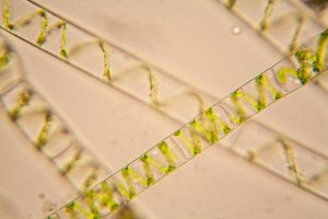 Vláknitá řasa z rodu šroubatek (Spirogyra) pod mikroskopem – ileana_bt / Shutterstock
