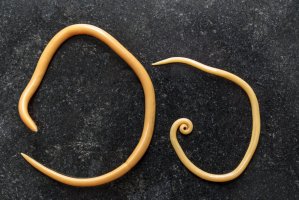 Škrkavka dětská (Ascaris lumbricoides) – Rattiya Thongdumhyu / Shutterstock