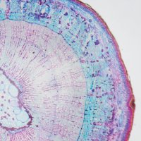 mikrofotograficky zachycen stonek dvoudomé rostliny – David Herraez Calzada / Shutterstock