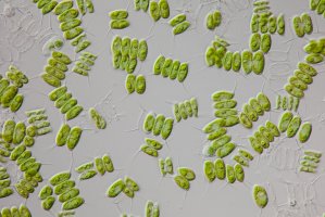 Scenedesmus quadricauda – Lebendkulturen.de / Shutterstock