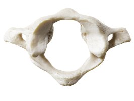 Atlas, první krční obratel člověka, 3D ilustrace – SciePro / Shutterstock