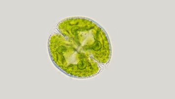 Řasa Cosmarium obsoletum, snímek z mikroskopu – Ekky Ilham / Shutterstock