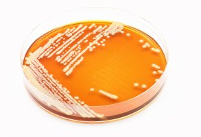 Kolonie kvasinek (Saccharomyces boulardii) – TopMicrobialStock / Shutterstock