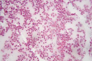 Mikroskopický snímek lidské krve s prvokem Trypanosoma brucei, původcem africké trypanosomózy (spavé nemoci) – ChWeiss / Shutterstock