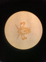 Muňka (Phthirus pubis) pod mikroskopem – Anestial / Shutterstock