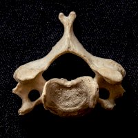 Krční obratel člověka (C3–C6) – Meta Zahren / Unsplash