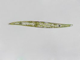 Rozsivka Gyrosigma pod mikroskopem – Elif Bayraktar / Shutterstock