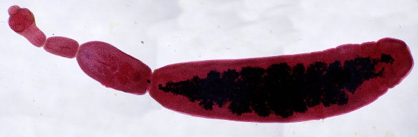 Měchožil zhoubný (Echinococcus granulosus) pod mikroskopem – D. Kucharski K. Kucharska / Shutterstock