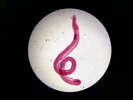 Schistosoma japonicum pod mikroskopem – Adsaliba / Shutterstock