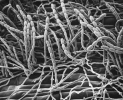 Padlí travní (Erysiphe graminis), zobrazení elektronovým mikroskopem – Profimedia.CZ