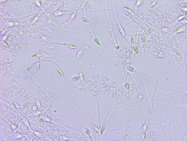 Lidské sperma pod mikroskopem – Lukasz Pawel Szczepanski / Shutterstock